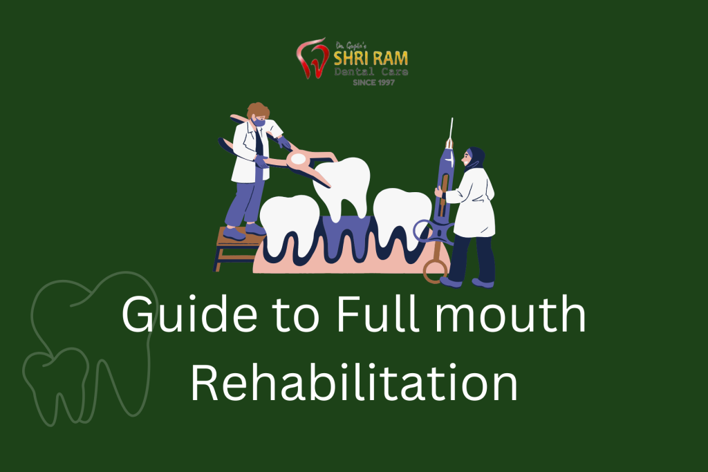 Guide to Full mouth Rehabilitation